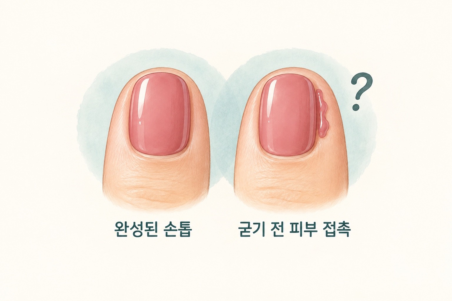 완성된 젤 네일의 모습과 굳기 전 재료가 손톱 옆 피부에 닿을 수 있는 상황을 구분한 개념 삽화